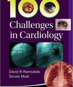 100 Challenges In Cardiology ebook
