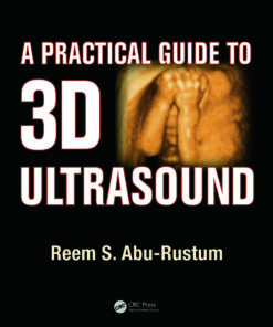 A Practical Guide to 3D Ultrasound ebook