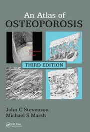 An Atlas of Osteoporosis ebook