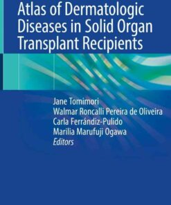 Atlas of Dermatologic Diseases in Solid Organ Transplant Recipients ebook