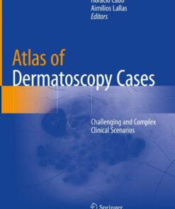 Atlas of Dermatoscopy Cases: Challenging and Complex Clinical Scenarios ebook