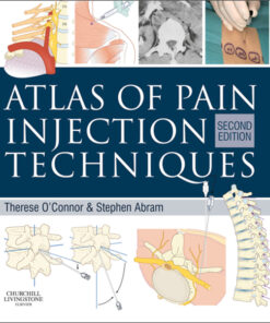 Atlas of Pain Injection Techniques ebook