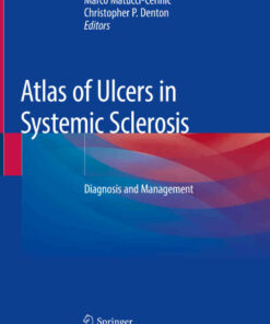 Atlas of Ulcers in Systemic Sclerosis: Diagnosis and Management ebook