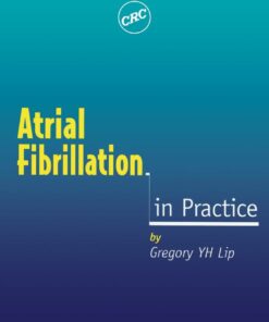Atrial Fibrillation in Practice ebook