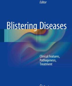 Blistering Diseases: Clinical Features Pathogenesis Treatment ebook