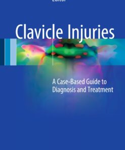 Clavicle Injuries: A Case-Based Guide to Diagnosis and Treatment ebook