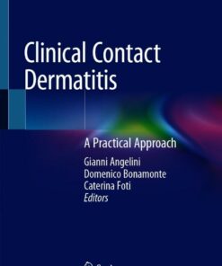 Clinical Contact Dermatitis: A Practical Approach ebook