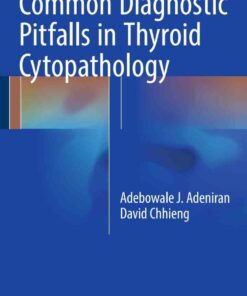 Common Diagnostic Pitfalls in Thyroid Cytopathology ebook