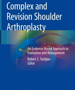 Complex and Revision Shoulder Arthroplasty: An Evidence-Based Approach to Evaluation and Management ebook