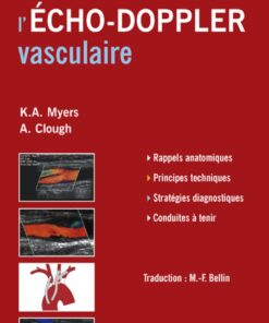 Comprendre l'Echo-Doppler vasculaire ebook