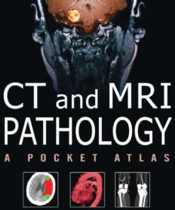 CT & MRI Pathology: A Pocket Atlas Second Edition ebook