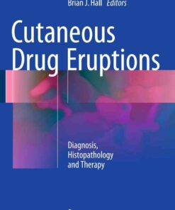 Cutaneous Drug Eruptions: Diagnosis Histopathology and Therapy ebook