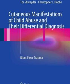 Cutaneous Manifestations of Child Abuse and Their Differential Diagnosis: Blunt Force Trauma ebook