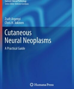 Cutaneous Neural Neoplasms: A Practical Guide ebook