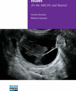 Early Pregnancy Issues for the MRCOG and Beyond ebook