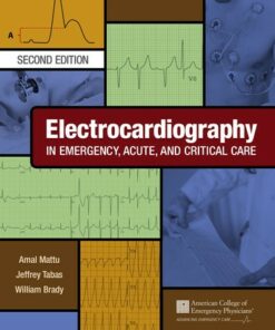 Electrocardiography in Emergency Acute and Critical Care 2nd Edition ebook