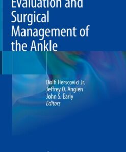 Evaluation and Surgical Management of the Ankle ebook