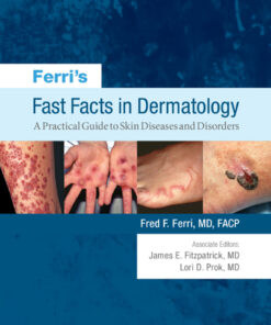 Ferri's Fast Facts in Dermatology: A Practical Guide to Skin Diseases and Disorders ebook