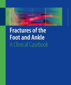 Fractures of the Foot and Ankle: A Clinical Cas
 ebook
