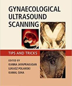 Gynaecological Ultrasound Scanning: Tips and Tricks ebook