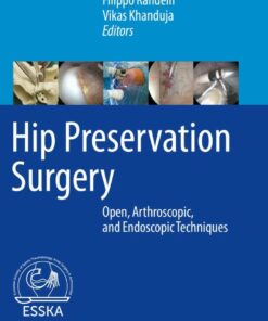 Hip Preservation Surgery: Open Arthroscopic and Endoscopic Techniques ebook