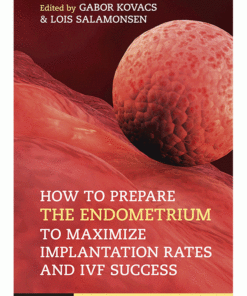 How to Prepare the Endometrium to Maximize Implantation Rates and IVF Success ebook