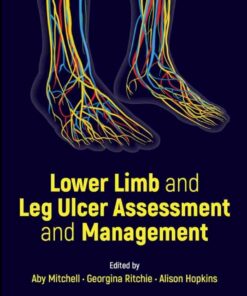 Lower Limb and Leg Ulcer Assessment and Management ebook
