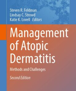 Management of Atopic Dermatitis: Methods and Challenges ebook
