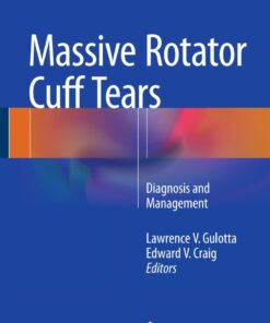 Massive Rotator Cuff Tears: Diagnosis and Management ebook