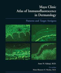 Mayo Clinic Atlas of Immunofluorescence in Dermatology: Patterns and Target Antigens ebook