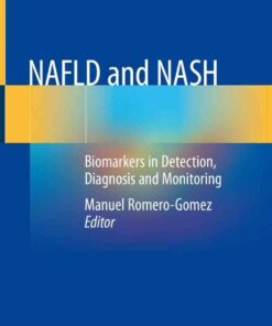 NAFLD and NASH: Biomarkers in Detection Diagnosis and Monitoring ebook