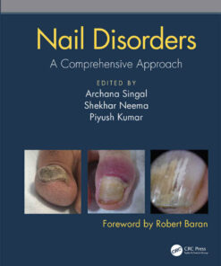 Nail Disorders: A Comprehensive Approach ebook