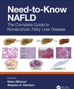 Need-to-Know NAFLD: The Complete Guide to Nonalcoholic Fatty Liver Disease ebook