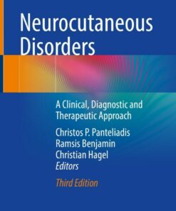 Neurocutaneous Disorders: A Clinical Diagnostic and Therapeutic Approach ebook