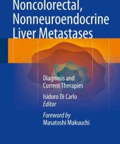 Noncolorectal Nonneuroendocrine Liver Metastases: Diagnosis and Current Therapies ebook