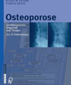 Osteoporose: Leitliniengerechte Diagnostik und Therapie mit 25 Fallbeispielen ebook