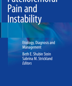 Patellofemoral Pain and Instability: Etiology Diagnosis and Management ebook