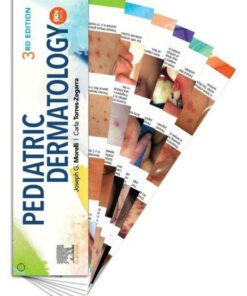 Pediatric Dermatology DDX Deck In ebook