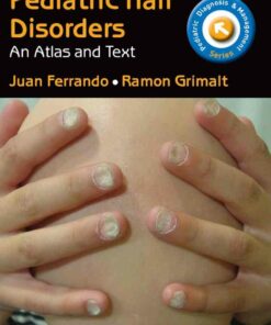 Pediatric Hair Disorders: Atlas and Text T  ebook