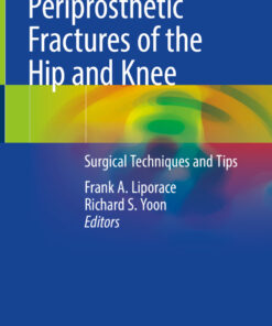 Periprosthetic Fractures of the Hip and Knee: Surgical Techniques and Tips ebook