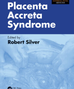 Placenta Accreta Syndrome ebook