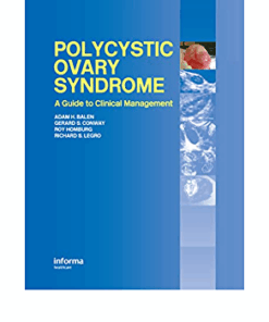 Polycystic Ovary Syndrome: A Guide to Clinical Management ebook