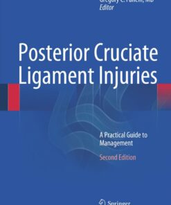 Posterior Cruciate Ligament Injuries: A Practical Guide to Management ebook