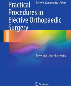 Practical Procedures in Elective Orthopaedic Surgery: Pelvis and Lower Extremity ebook