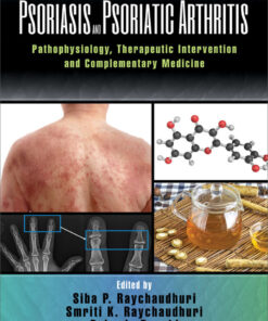 Psoriasis and Psoriatic Arthritis: Pathophysiology Therapeutic Intervention and Complementary Medicine ebook