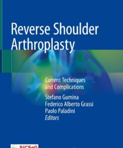 Reverse Shoulder Arthroplasty: Current Techniques and Complications ebook
