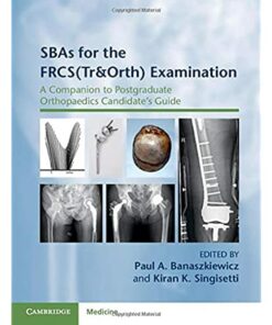 SBAs for the FRCS(Tr&Orth) Examination: A Companion to Postgraduate Orthopaedics Candidate's Guide ebook