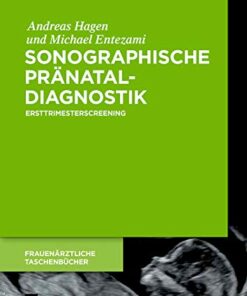 Sonographische Pr�nataldiagnostik: Ersttrimesterscreening ebook