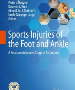 Sports Injuries of the Foot and Ankle: A Focus on Advanced Surgical Techniques ebook