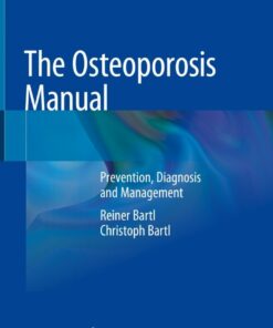 The Osteoporosis Manual: Prevention Diagnosis and Management ebook